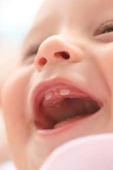 Baby: Gesunde Zähne - Entwicklung und Pflege